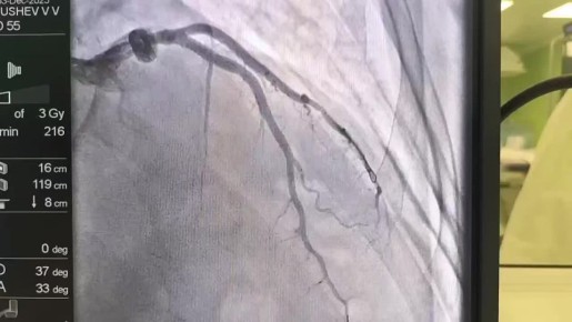 «Каждая минута — на счету»: вчера эта фраза спасла человеку жизнь