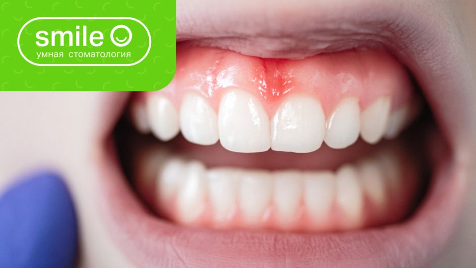 ����� ���� �� ������: ���������� ������� ��� ��������������� ������?