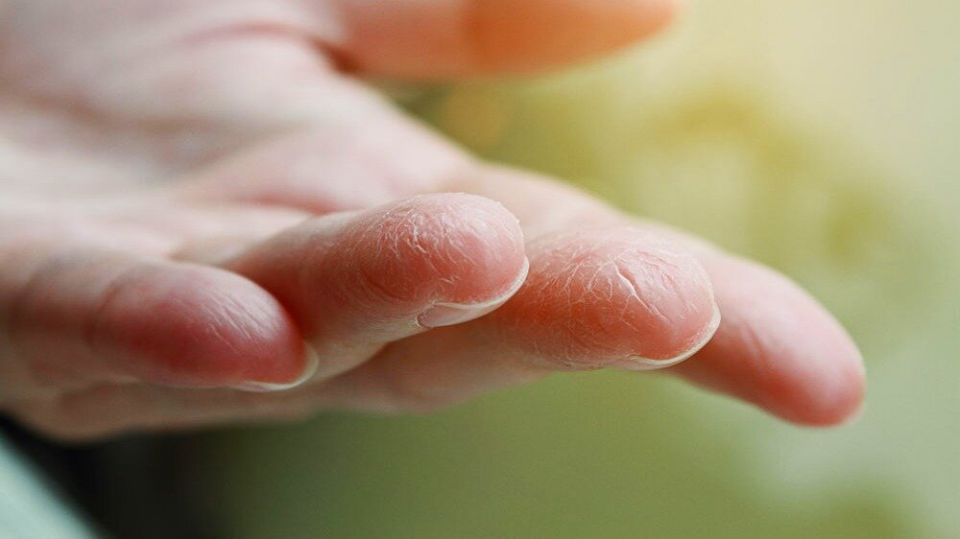 Советское средство, восстановившее мои руки за три дня: рецепт из прошлого